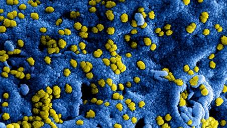 Drie inwoners gemeente Waalwijk besmet met coronavirus